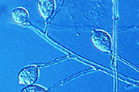 Micrograph of sporangia